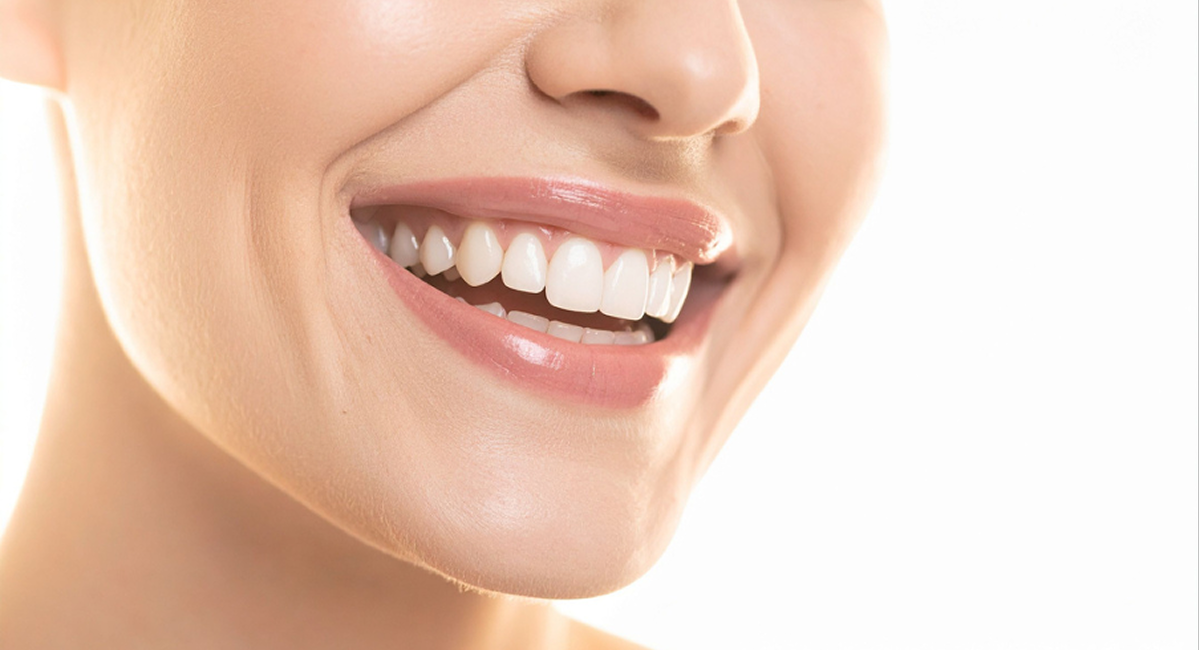 セラミック治療の満足度を左右する3つの質