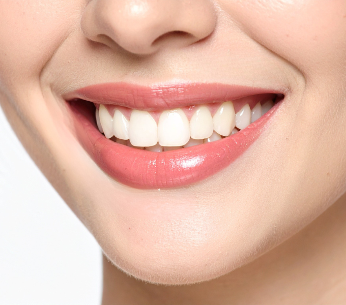 お口全体の審美歯科