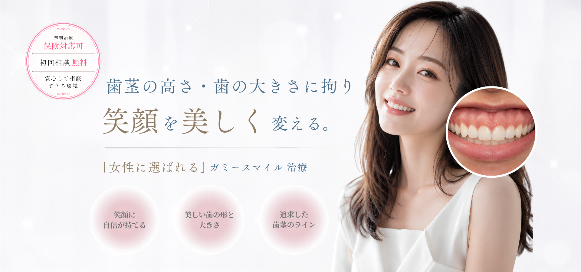 ガミースマイル
